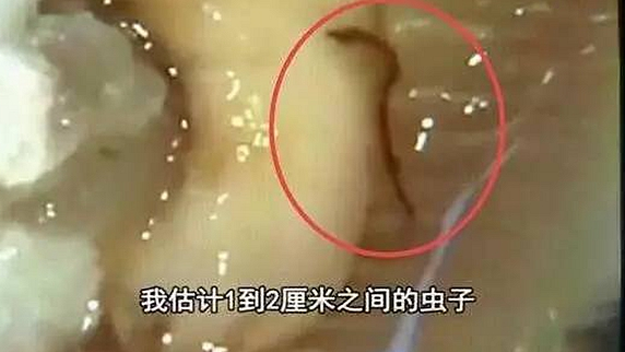 一只生蠔引起的冤案，觸動了餐飲人的“麻木神經(jīng)”